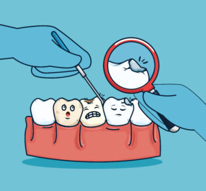 teeth treatment